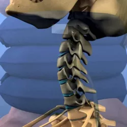 Necktrak
