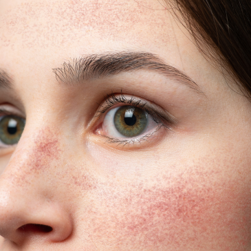372_88781_bloc-silica-visage-cou-2.png